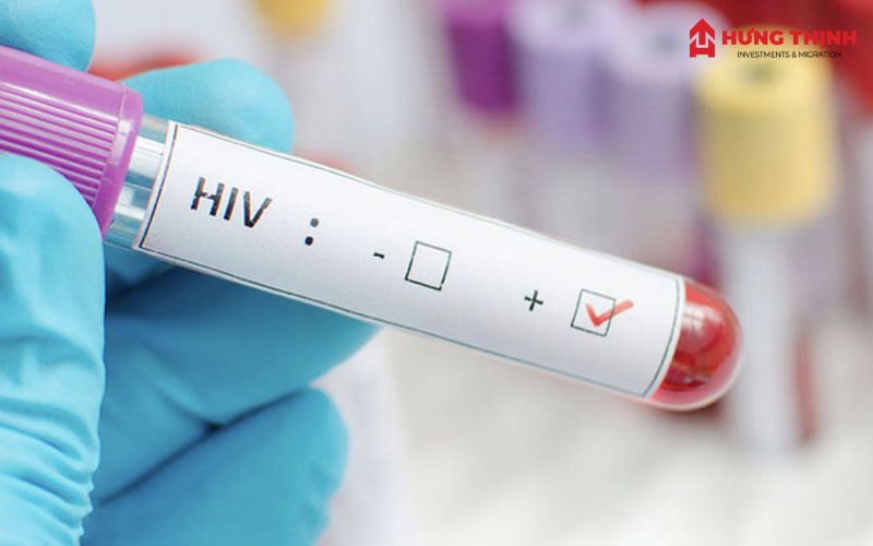 Định cư Mỹ có xét nghiệm HIV không? Cập nhật mới nhất 2025 5 định cư mỹ có xét nghiệm hiv không